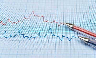 How to read a candlestick chart